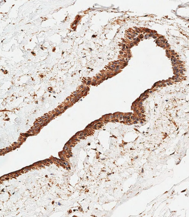 ASM Antibody in Immunohistochemistry (Paraffin) (IHC (P))