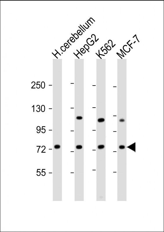 ASM Antibody in Western Blot (WB)