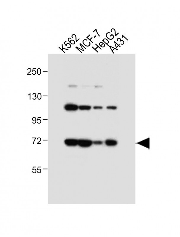 ASM Antibody in Western Blot (WB)