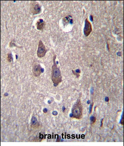 PCDHB12 Antibody in Immunohistochemistry (Paraffin) (IHC (P))