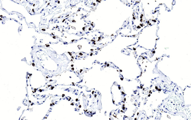 SFTPC Antibody in Immunohistochemistry (Paraffin) (IHC (P))