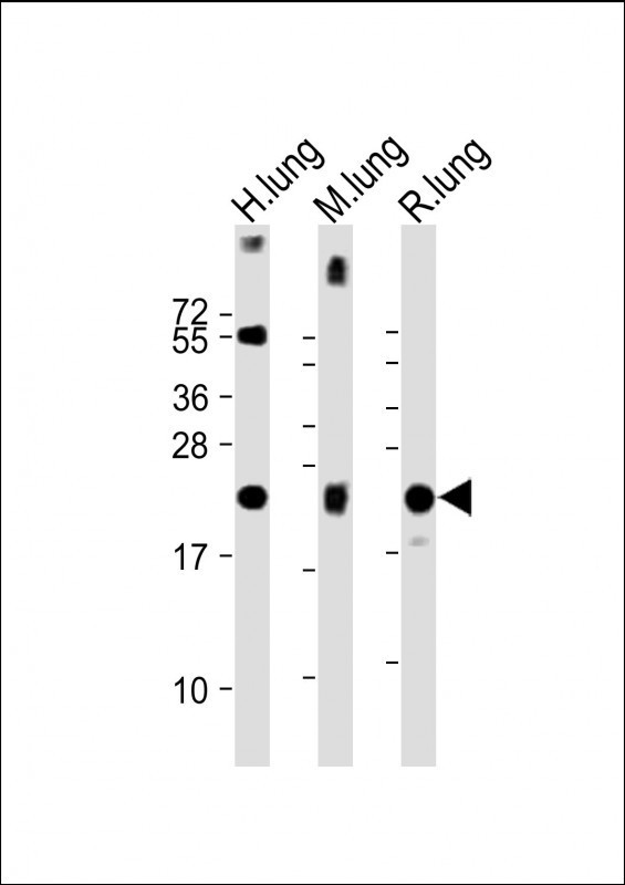 SFTPC Antibody in Western Blot (WB)