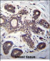 eIF2b alpha Antibody in Immunohistochemistry (Paraffin) (IHC (P))