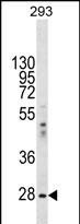 eIF2b alpha Antibody in Western Blot (WB)