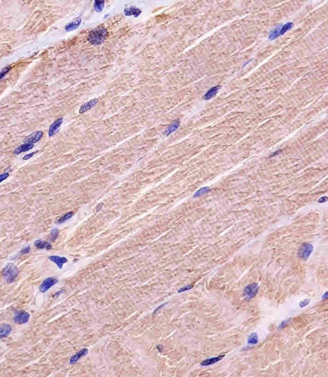 MYBPC3 Antibody in Immunohistochemistry (Paraffin) (IHC (P))