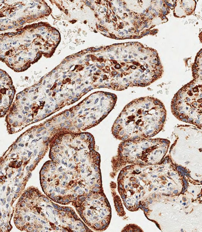 GAA Antibody in Immunohistochemistry (Paraffin) (IHC (P))