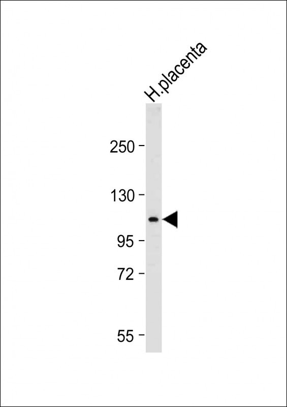 GAA Antibody in Western Blot (WB)