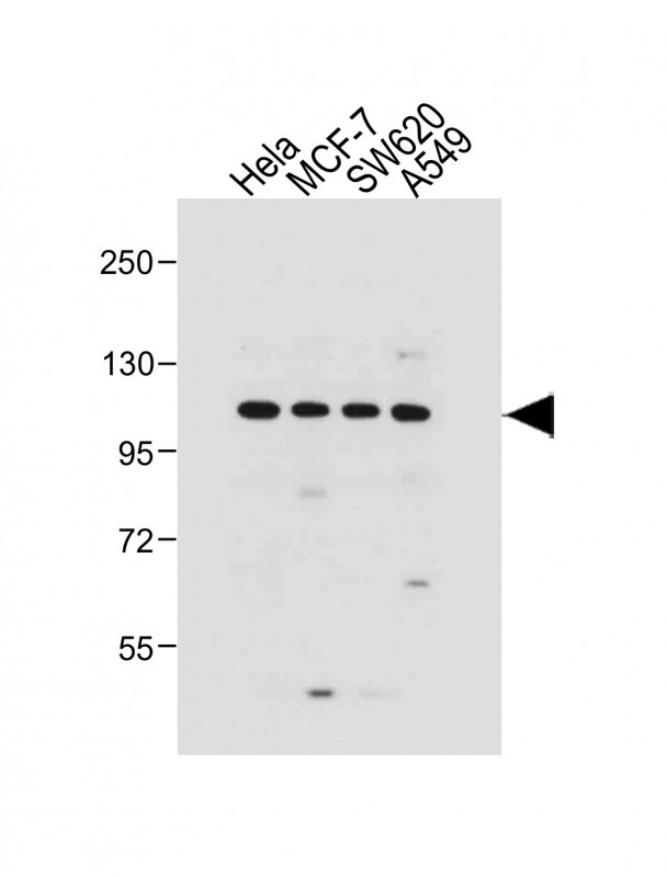 GAA Antibody in Western Blot (WB)