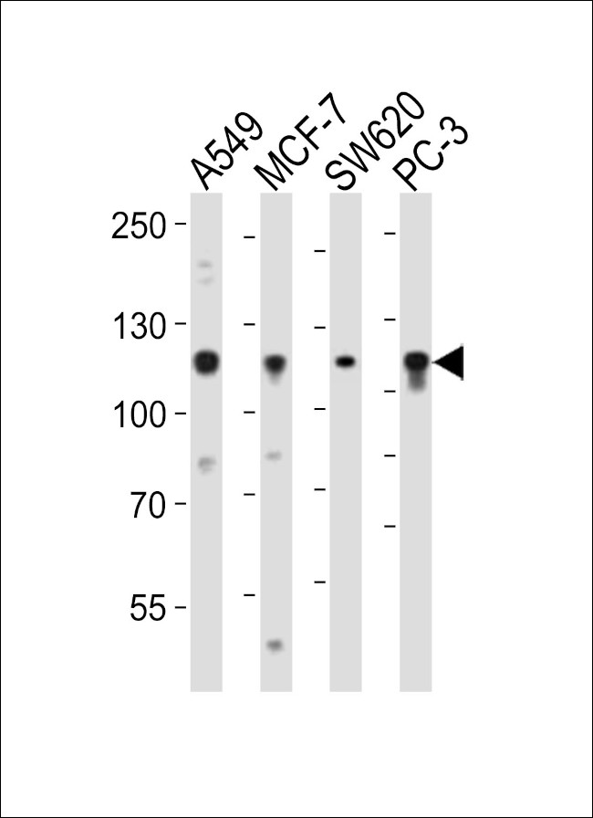 GAA Antibody in Western Blot (WB)