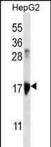 KRTAP1-3 Antibody in Western Blot (WB)