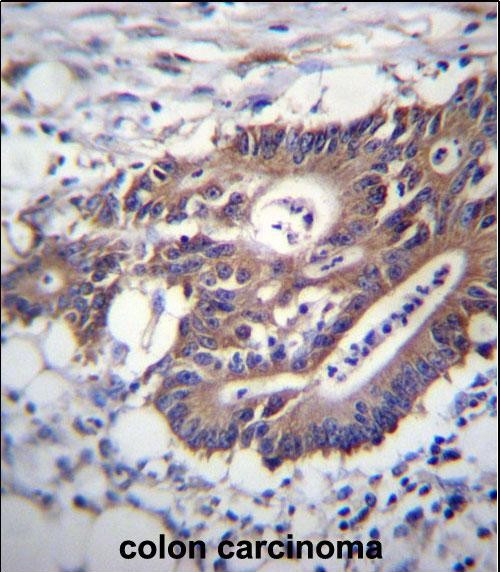 Cytokeratin 12 Antibody in Immunohistochemistry (Paraffin) (IHC (P))