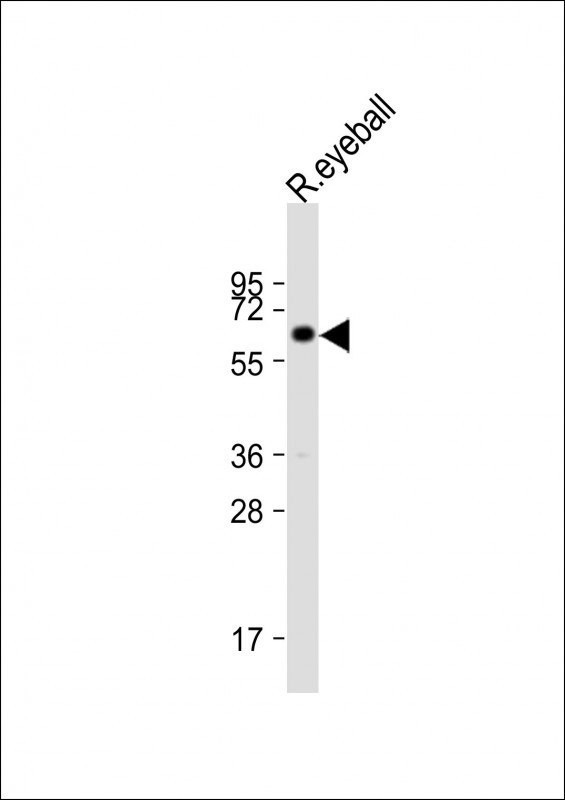 Cytokeratin 12 Antibody in Western Blot (WB)