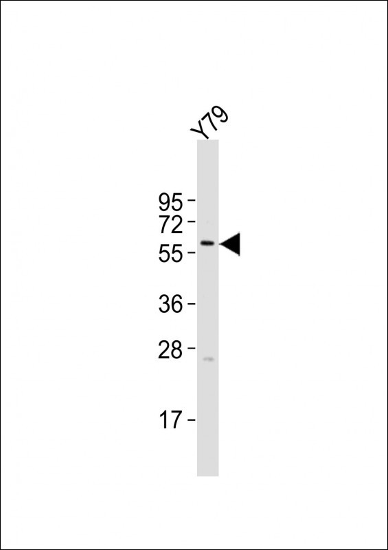 Cytokeratin 12 Antibody in Western Blot (WB)