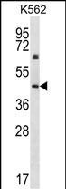 Cytokeratin 12 Antibody in Western Blot (WB)