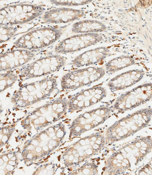 SFRP5 Antibody in Immunohistochemistry (Paraffin) (IHC (P))