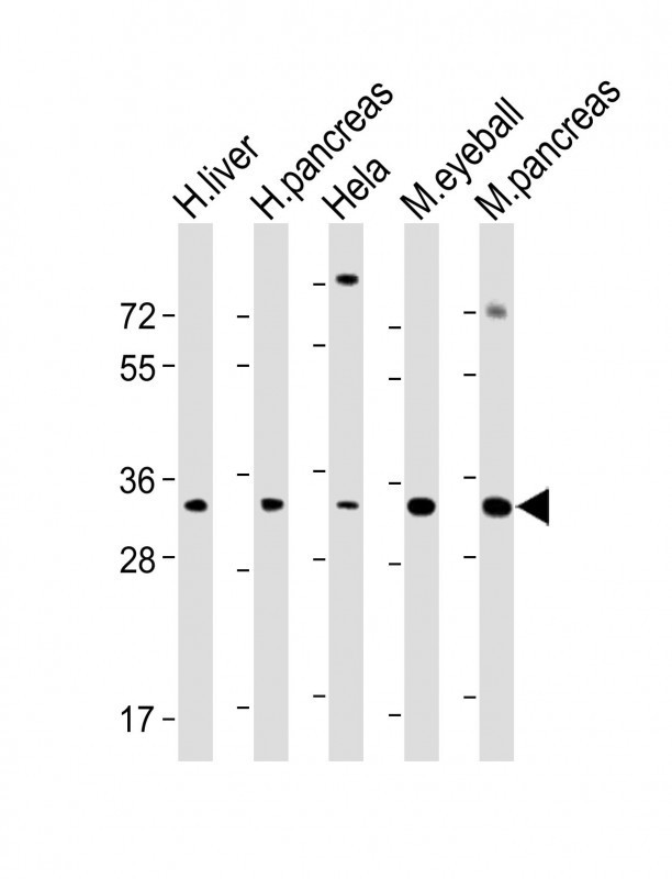 SFRP5 Antibody in Western Blot (WB)