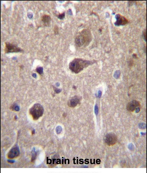 MRAP2 Antibody in Immunohistochemistry (Paraffin) (IHC (P))