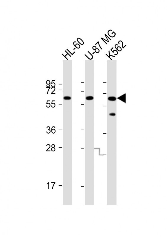 IL1RL2 Antibody in Western Blot (WB)