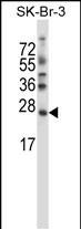 SDF2L1 Antibody in Western Blot (WB)