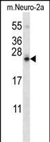 SDF2L1 Antibody in Western Blot (WB)