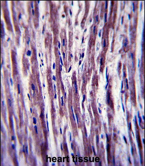 HACD1 Antibody in Immunohistochemistry (Paraffin) (IHC (P))