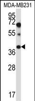 HACD1 Antibody in Western Blot (WB)