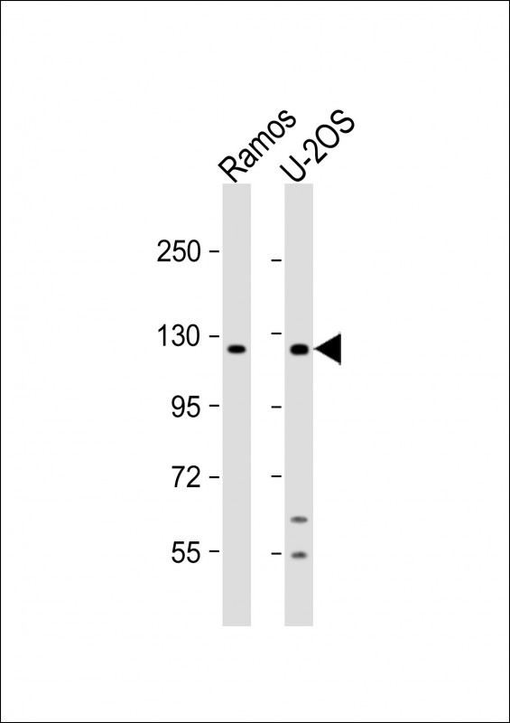 Ubinuclein 2 Antibody in Western Blot (WB)