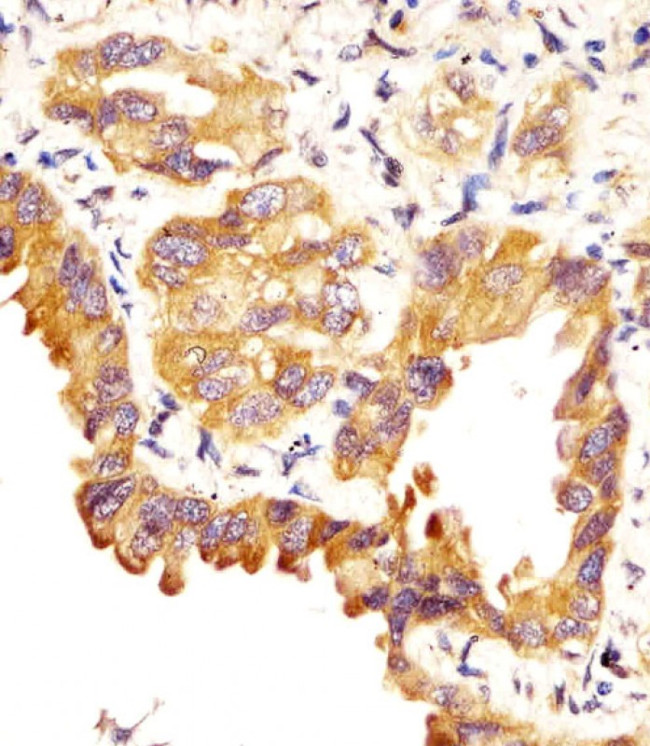 SFTPC Antibody in Immunohistochemistry (Paraffin) (IHC (P))