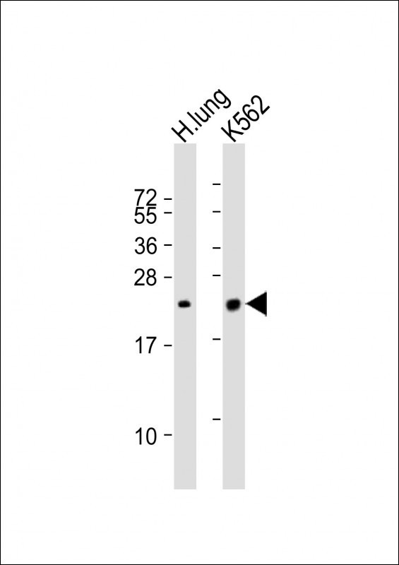 SFTPC Antibody in Western Blot (WB)