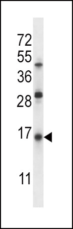 SFTPC Antibody in Western Blot (WB)