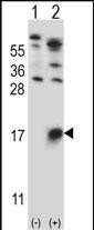 GYPB Antibody in Western Blot (WB)