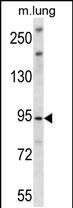 UNC45B Antibody in Western Blot (WB)