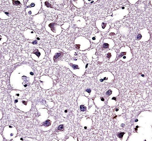 LPL Antibody in Immunohistochemistry (Paraffin) (IHC (P))