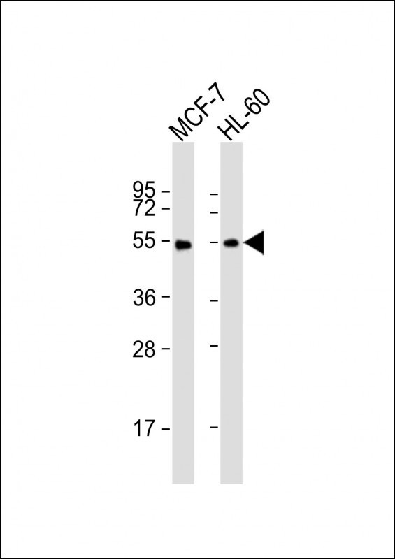 LPL Antibody in Western Blot (WB)