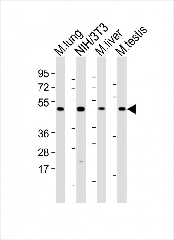 MLKL Antibody in Western Blot (WB)