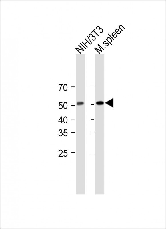 MLKL Antibody in Western Blot (WB)