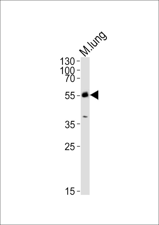 MLKL Antibody in Western Blot (WB)