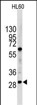 LIN28B Antibody in Western Blot (WB)