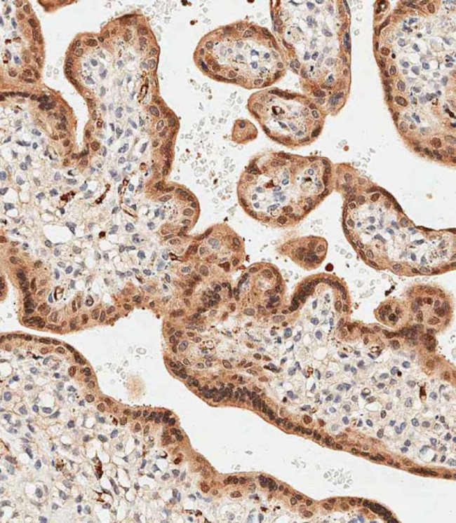 LIN28B Antibody in Immunohistochemistry (Paraffin) (IHC (P))