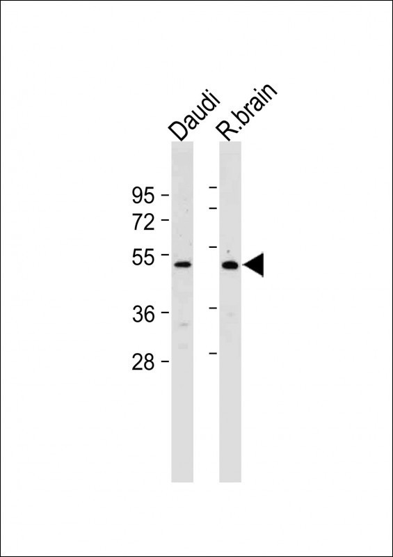 GPR30 Antibody in Western Blot (WB)