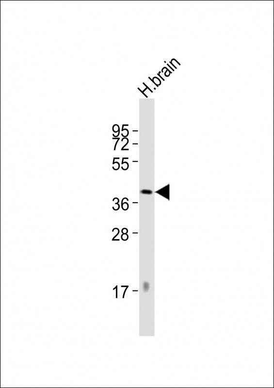 DRD2 Antibody in Western Blot (WB)