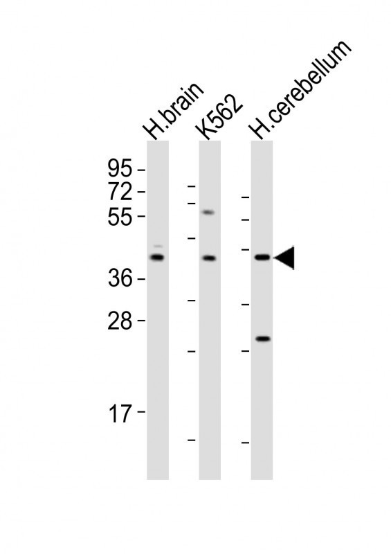 DRD2 Antibody in Western Blot (WB)