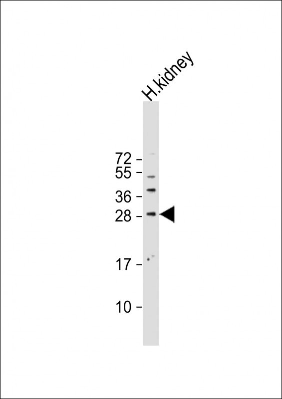 Sclerostin Antibody in Western Blot (WB)