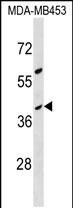 OR10G8 Antibody in Western Blot (WB)