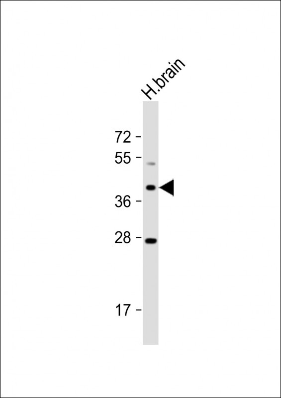 OR5M8 Antibody in Western Blot (WB)