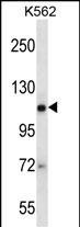 AGO2 Antibody in Western Blot (WB)