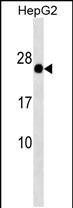 GAGE12F/GAGE12G/GAGE12I Antibody in Western Blot (WB)