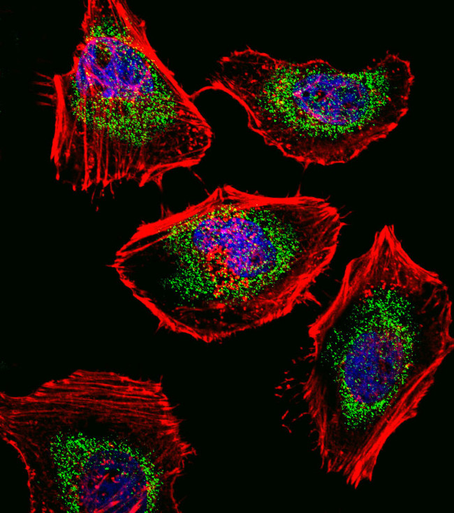 SOX4 Antibody in Immunocytochemistry (ICC/IF)