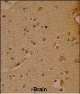 SOX4 Antibody in Immunohistochemistry (Paraffin) (IHC (P))