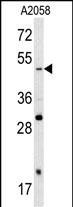 SOX4 Antibody in Western Blot (WB)